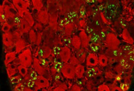 claire-demiot-MMPP-Prévenir-les-neuropathies-périphériques-induites-pas-la-chimiothérapie
