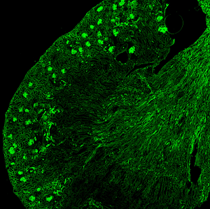 Dépôts d'anticorps