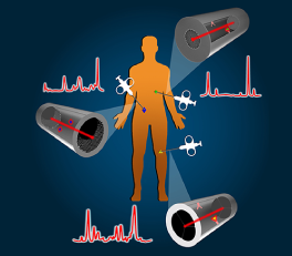 projet-xlim-fibermed-universite-limoges-unilim
